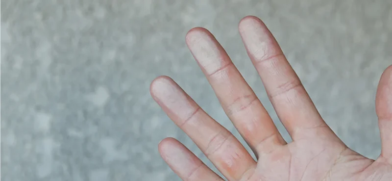 Lỗi màng sơn tĩnh điện phấn hóa và cách xử lý